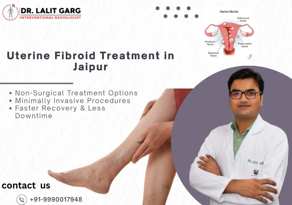 Uterine Fibroid Treatment in Jaipur