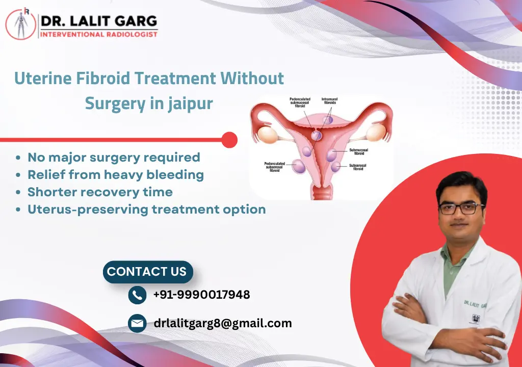 Uterine Fibroid Treatment Without Surgery in Jaipur